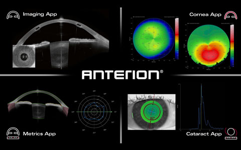 ANTERION