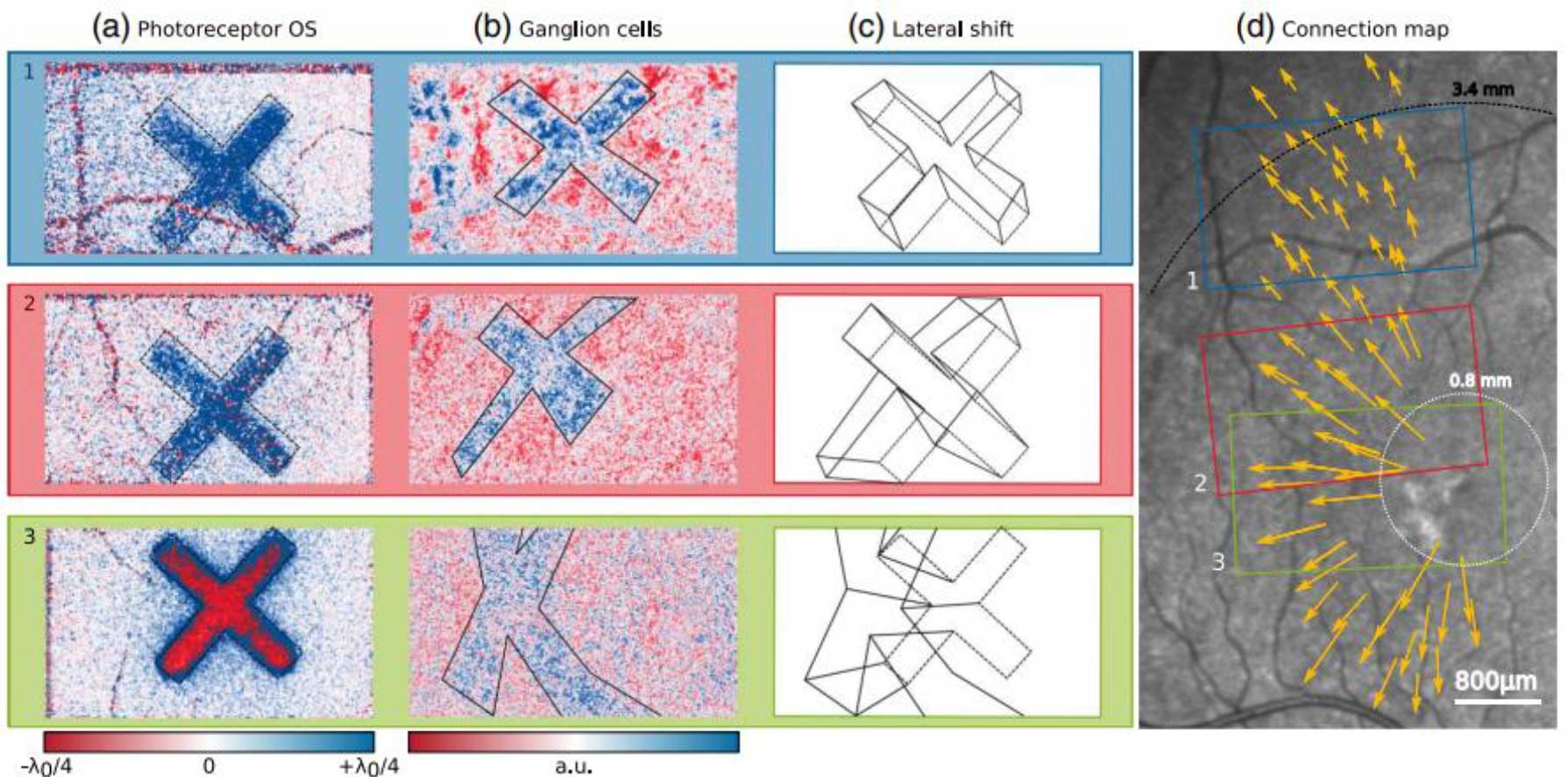 © Optics Letters: Clara Pfäffle, Hendrik Spahr et al, “Simultaneous functional imaging of neuronal and photoreceptor layers in living human retina,” Opt. Lett. 44(23), 5671-5674 (2019)