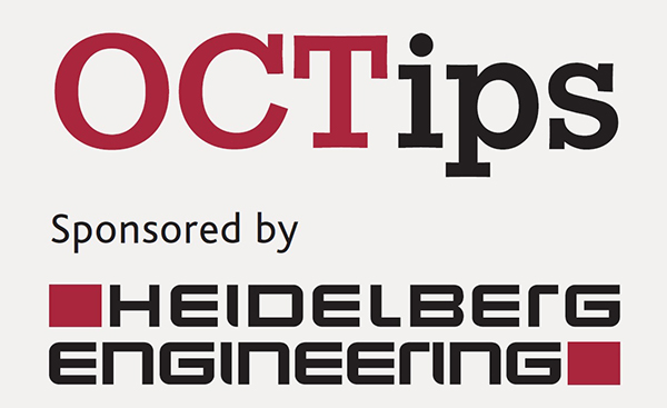 313049-001_Heidelberg-Engineering-launches-OCTips-column-in-collaboration-with-Dispensing-Optics-Magazine_OCTips