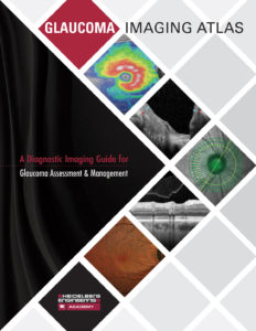 Cover of the Glaucoma Imaging Atlas