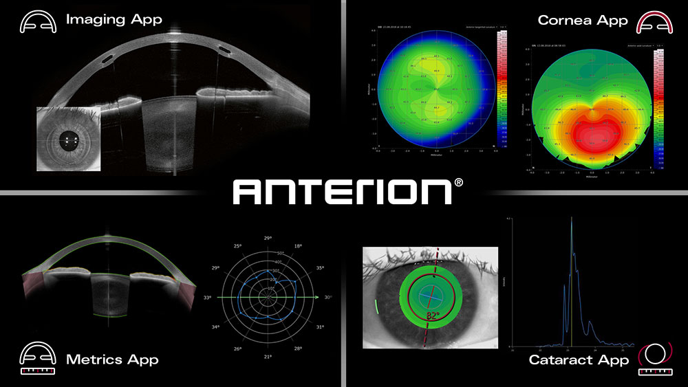 ANTERION